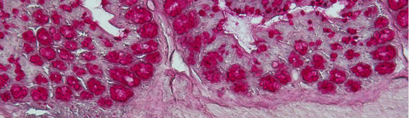 Cluster Allergy and Immunity - Gut cross section, histological staining (C. Ohnmacht)